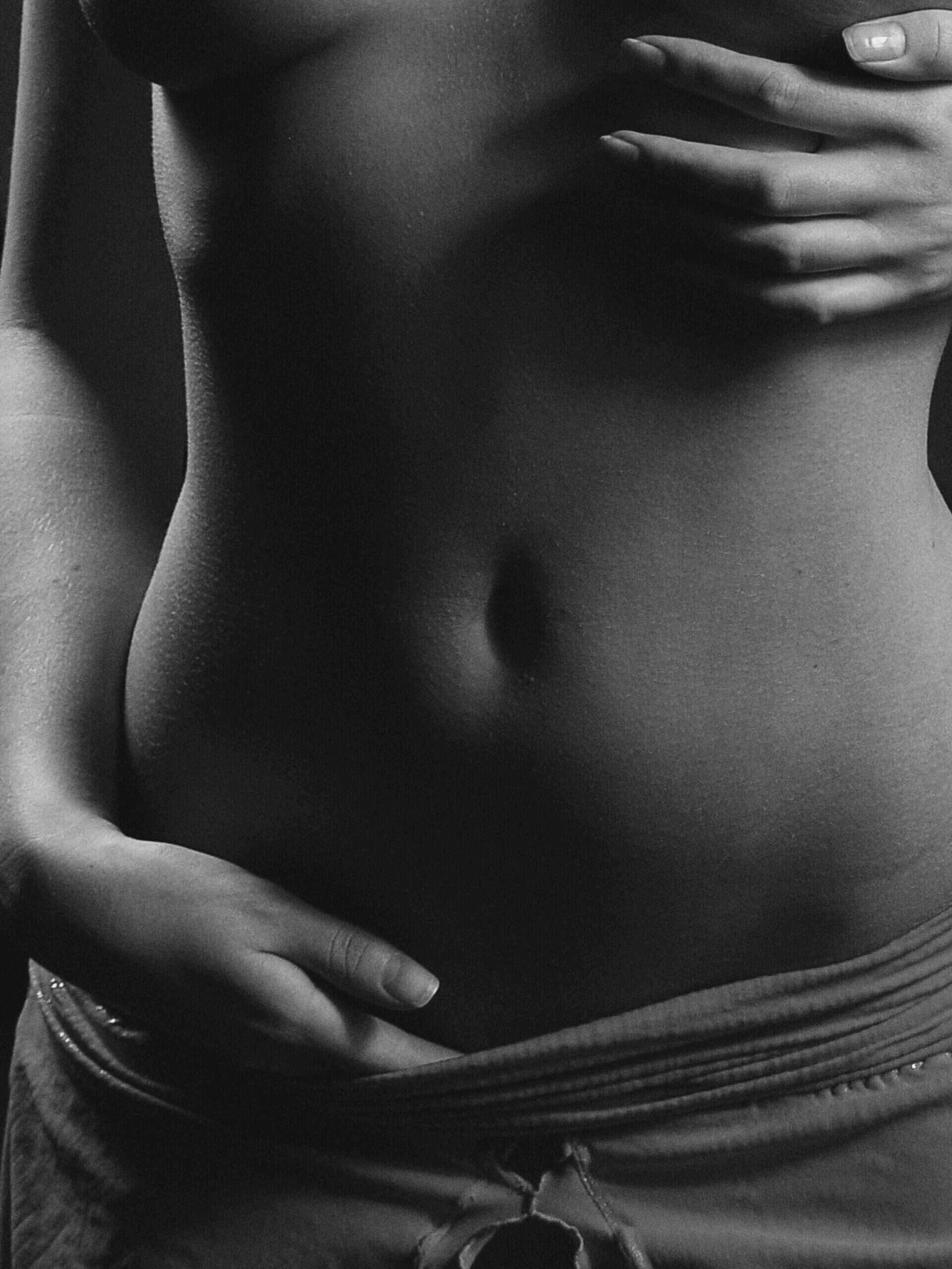 Woman's Stomach with Stretch Marks | Prick'd Medspa in St. Louis, MO