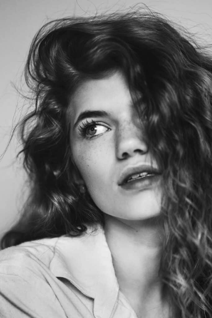 Dermal Fillers in ST Louis, MO | Prick'd Med Spa in ST Louis, MO