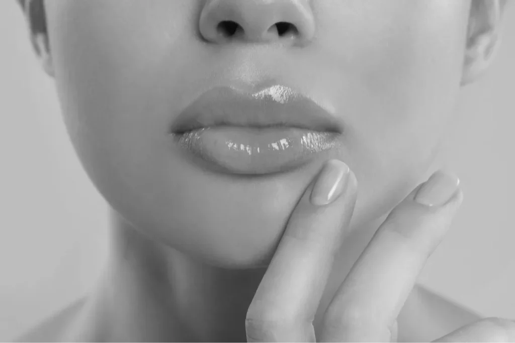 Lip Flip Botox
