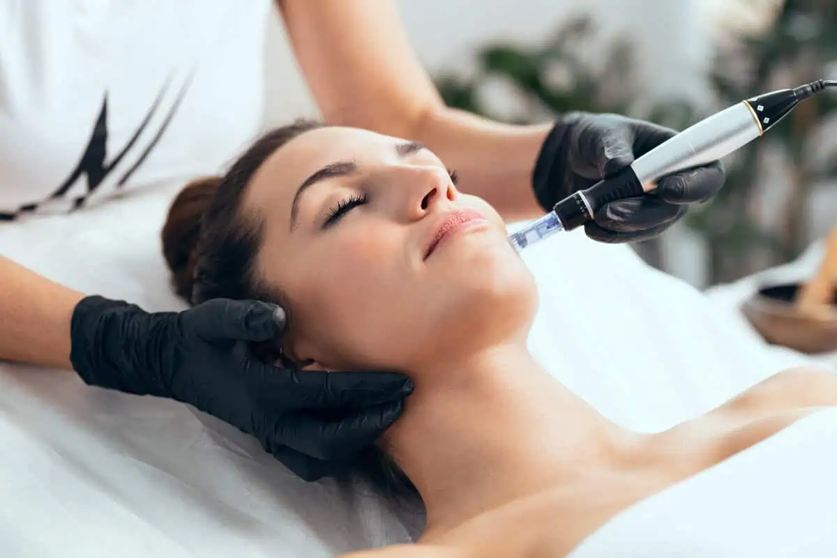 Microneedling Safe for All Skin Types
