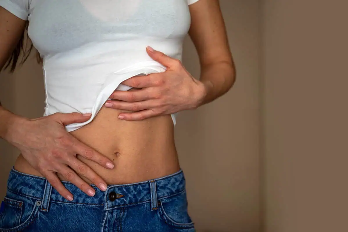 Aerolase Neo effect after post pregnancy treatment